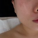 중앙동318 | 안산 중앙동 피부맛집, 처음으로 관리받아본 “더예쁜” 후기