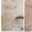 김언니피부샵