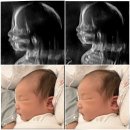 수지미래산부인과 초산 자연분만 후기 김동영원장님 / 39주차 5분만에 출산👼🏻