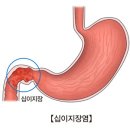 십이지장염 이미지