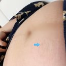 임산부인과의원 | 임신16주차) 김건우산부인과 양수검사+신경관 결손 검사