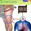 체한 분 무릎 두드려 멍을 냈는데 어지럽다고 이미지