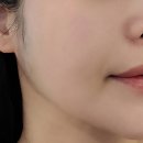 제이제이에스테틱 이미지