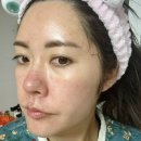 잔티 | 다이소 5천원짜리 클리덤 리포좀 비타민씨 캡슐 잡티 진짜 얼굴 환해지나요? 제가 써봤어요!