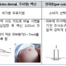 비씨지