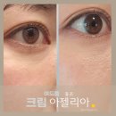 중앙기전 | 아젤리아 크림 여드름 홍조 효과 있을까? 아젤라산 기전 가격 사용법 한 달 후기