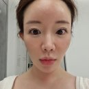 신사역5번출구 | 신사역피부과 온다리프팅 6만줄 내돈내산 리얼후기 주의사항