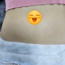 천안탈모튼살스킨커버아카데미 이미지