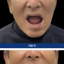 아치치과기공소 이미지