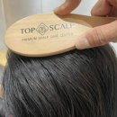 스칼프K | 탑스칼프 사당 / 사당탈모 관리로 적극 추천하는 유명 두피케어 브랜드 본점 솔직 후기