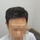 가발로 중년남자의 멋짐을 보여주세요 [수원가발]