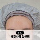 태후사랑 | 철산두피탈모 태후사랑 지루성두피염 광명두피케어 후기
