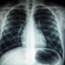 은평밝은내과의원 이미지