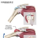 스매쉬스파이크