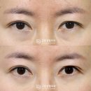 디비성형외과의원 이미지
