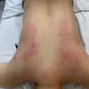 더안 | [뷰티]진주산후관리, 더안뷰티 등관리 후기