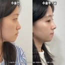 아우어성형외과의원 이미지