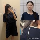 얼굴 비대칭 교정 한의원 3회차 ing 눈, 턱 치료 내돈내산 후기 (가격, 효과)