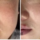 클레르 피부샵 네이버블로그