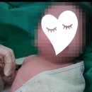 에프씨에스 | 대전더블유여성병원_제왕절개후기