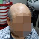 모위드헤어