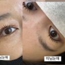 블링수 이미지