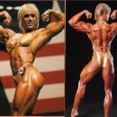 (조장글X) 스테로이드 사용후 20년이 지난 올림피아 여자 선수 Woman 20 years after taking huge doses of steroids back in the 1990s (former bodybuilder 이미지