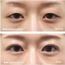 옳은손성형외과