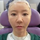 GH자연건강 잠실점 | 잠실 피부과 온다+티타늄 리프팅 효과 내돈내산 후기