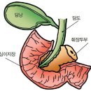 췌장이 병들면 몸에 보내는 신호 이미지