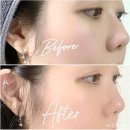 피부장벽 크림으로 피부탄력관리 후기 ❝마이스킨솔로지 세라피토신 모이스트 라인 3종❞