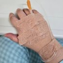 이천에스한의원 | 이천 에스한의원 교통사고 입원 후기