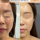 찌니네일 네이버블로그