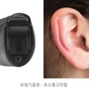 독일안경보청기 이미지