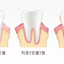 서울굿모닝치과 이미지