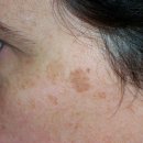 앤봄의원 이미지