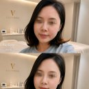 나를위한# | 대구 중구 피부관리 | 육아로 미뤄뒀던 나를 위한 리프팅, 브이에스테틱 후기