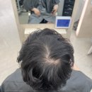 다솜헤어라인