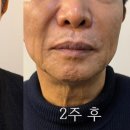 청담에이스의원 네이버블로그