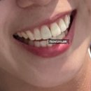 맘편한치과의원 네이버블로그