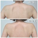 위더스 | 수원산후마사지 / 수원출장산후마사지 “위더스산후케어” 후기