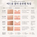 세종연세에스의원 | 세종주치의_연세에스의원 김원장이 전하는 피부과(진료과목) 정보 여드름흉터치료 시술 받기 전 알면...