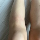 전 세계 유일한 버블 왁스 셀프 왁싱 키트인 제모스프레이 사용 방법과 후기