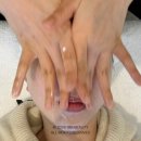 프로빅스 | 청담피부과 레드터치프로 콜라겐 탄력 셀빅스 레이저 스킨부스터 후기