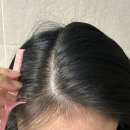 두피 안티에이징, 시작해 볼까 | 니옥신 나이트 덴시티 레스큐 두피 세럼, 여성탈모 헤어라인 잔머리 채우는 승무원 앰플 2주 후기