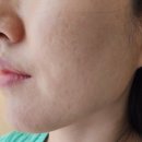 믿고가는 군자에스테틱 조각튜닝 바나나부띠끄 재방문 후기