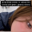 비비한의원 | 압구정 한의원 다이어트 한약 쿨쎄라 노블쉐이프 비비주사 1달 내돈내산 후기