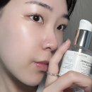 스타메디 | 비립종압출기 함부로 쓰면 안 되는 이유메디폴트 피토젠필 앰플 찐사용후기