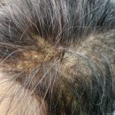 백모 | 원주 맞춤가발 수선 후기 | 타사 제품 스킨 교체 백모 혼합 증모 작업 기록