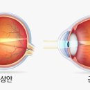 진주안경원 네이버블로그